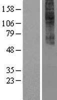 CCKAR Human Over-expression Lysate