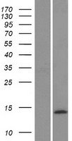 CGRP (CALCB) Human Over-expression Lysate