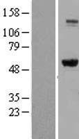 IMPDH2 Human Over-expression Lysate