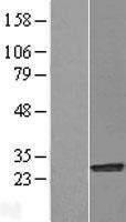 NQO2 Human Over-expression Lysate