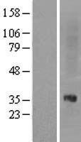 Nociceptin receptor (OPRL1) Human Over-expression Lysate
