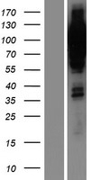 Progesterone Receptor (PGR) Human Over-expression Lysate