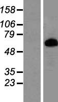 Prolactin Receptor (PRLR) Human Over-expression Lysate