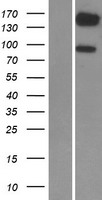 PDE3B Human Over-expression Lysate