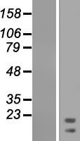RPL21 Human Over-expression Lysate