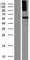 PDE9A Human Over-expression Lysate