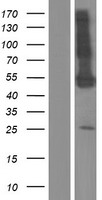 PDE9A Human Over-expression Lysate