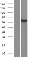 PDE9A Human Over-expression Lysate
