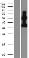 PDE9A Human Over-expression Lysate