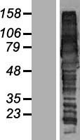 GGA1 Human Over-expression Lysate