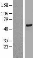 ROR gamma (RORC) Human Over-expression Lysate
