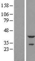 Cardiac Troponin T (TNNT2) Human Over-expression Lysate