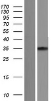 Cardiac Troponin T (TNNT2) Human Over-expression Lysate