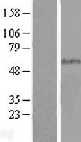 SMAD5 Human Over-expression Lysate