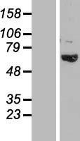 TBC1D3B Human Over-expression Lysate