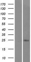 C9orf47 Human Over-expression Lysate