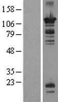 OR52N1 Human Over-expression Lysate