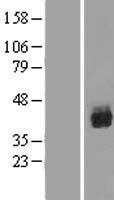 RUNX1 Human Over-expression Lysate