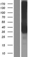 CD32B (FCGR2B) Human Over-expression Lysate