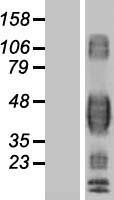 CD32B (FCGR2B) Human Over-expression Lysate