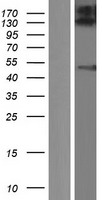 ZFYVE27 Human Over-expression Lysate