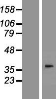 DGAT2L4 (AWAT2) Human Over-expression Lysate