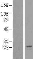 Apc11 (ANAPC11) Human Over-expression Lysate