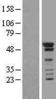 SMAD1 Human Over-expression Lysate