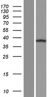 C11orf49 Human Over-expression Lysate