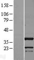 C11orf49 Human Over-expression Lysate