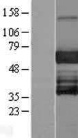 EBF3 Human Over-expression Lysate