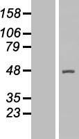 Arp2 (ACTR2) Human Over-expression Lysate