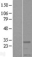 METTL2A Human Over-expression Lysate