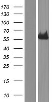GBA Human Over-expression Lysate
