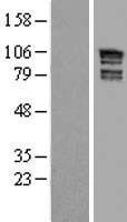 ARHGAP17 Human Over-expression Lysate