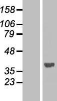 PPP1A (PPP1CA) Human Over-expression Lysate
