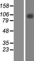 TFIP11 Human Over-expression Lysate