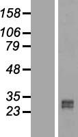 RUNDC2B Human Over-expression Lysate