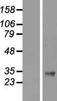 IGFBP3 Human Over-expression Lysate
