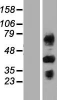 C4BPB Human Over-expression Lysate