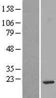 RPS14 Human Over-expression Lysate