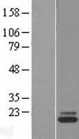 ARMETL1 (CDNF) Human Over-expression Lysate