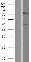 DIXDC1 Human Over-expression Lysate