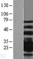 CD79B Human Over-expression Lysate