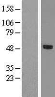 TBX20 Human Over-expression Lysate