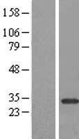 CPSF30 (CPSF4) Human Over-expression Lysate