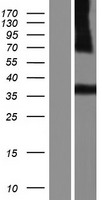 CD1E Human Over-expression Lysate