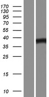 GCET1 (SERPINA9) Human Over-expression Lysate