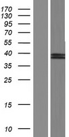 SUMF2 Human Over-expression Lysate