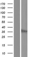 JKAMP Human Over-expression Lysate